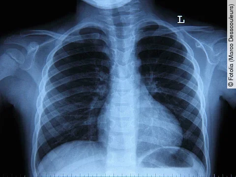 Radiologie Radiologie