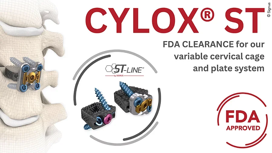 Wirbelsäulenimplantat Wirbelsäulenimplantat